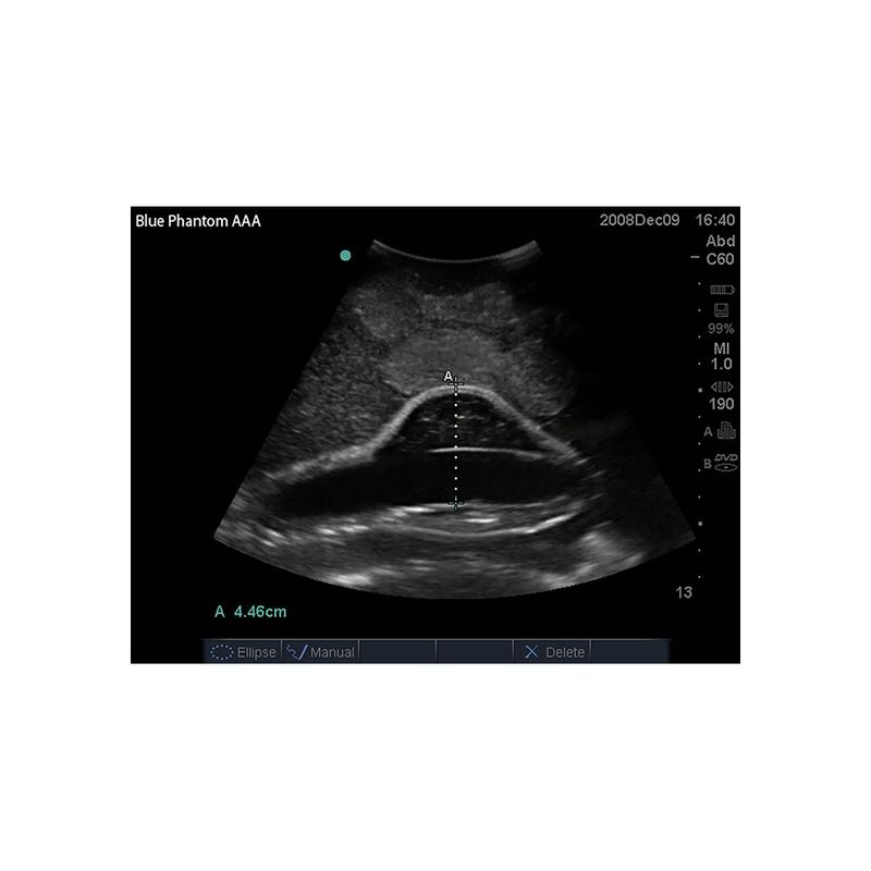 sagittal_aaa_ultrasound_medical_training_model