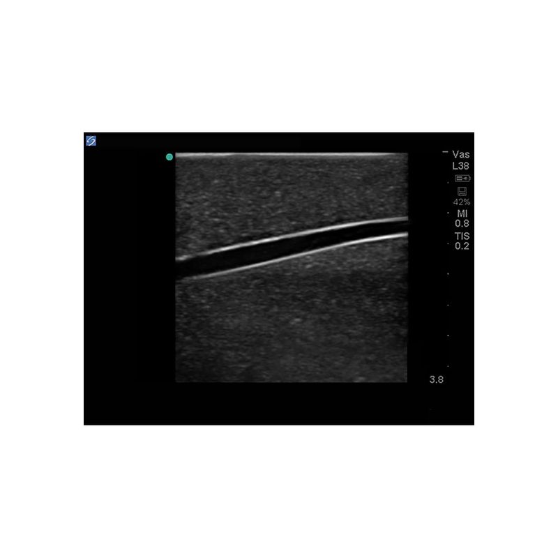 venous_access_ultrasound_image_sagittal_4-vessel