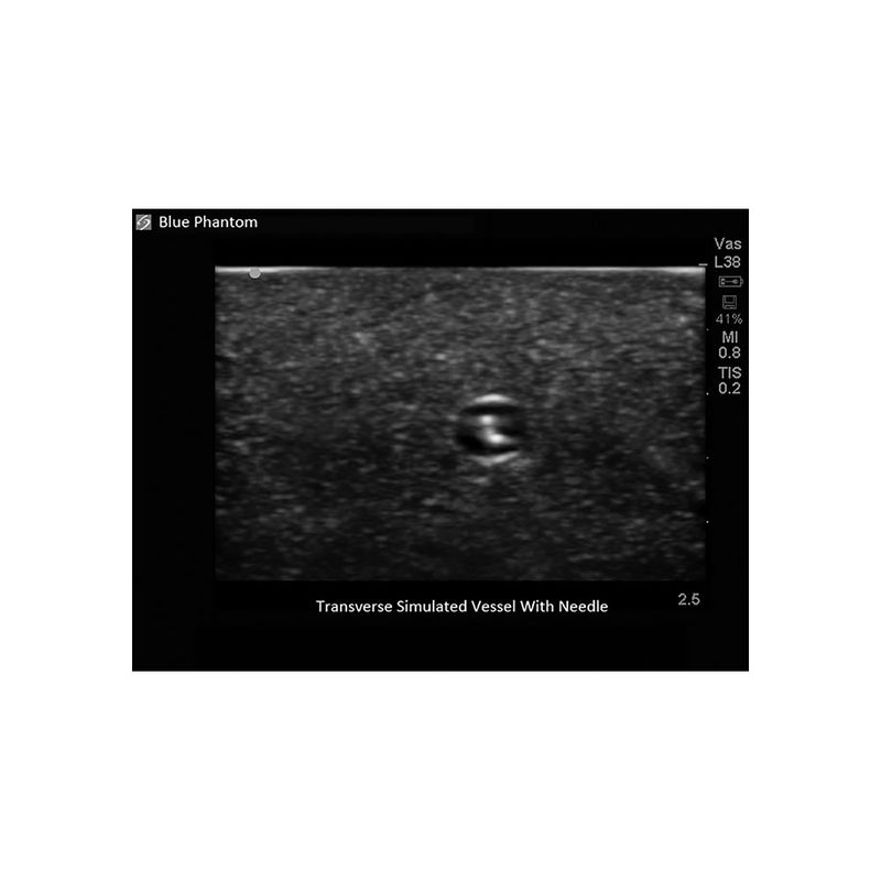 venous_access_ultrasound_image_transverse_needle