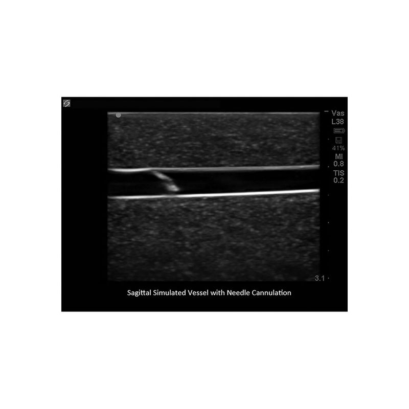 venous_access_ultrasound_image_sagittal_needle