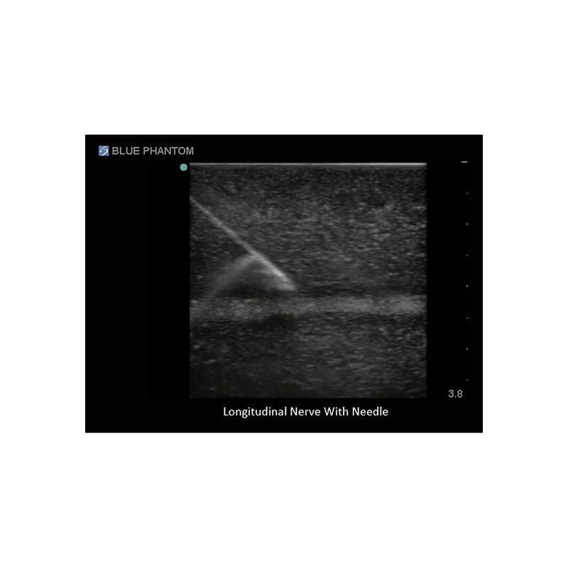 regional_anesthesia-sagittal_ultrasound_regional_anesthesia_nerves_needle