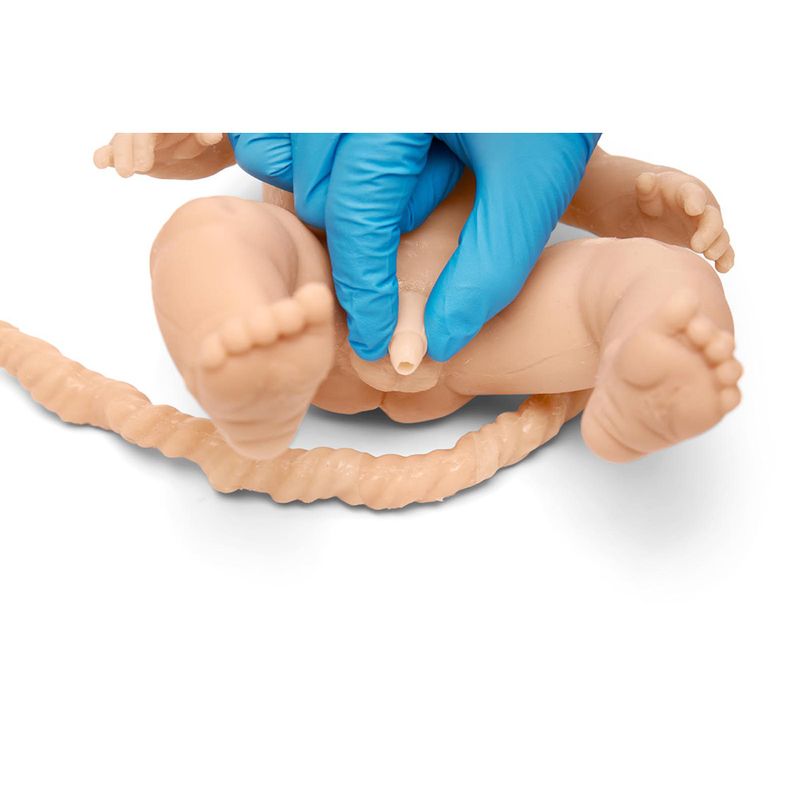 G-ONNP-001-B_act1_Newborn-Male-Genitalia-Foreskin-Light