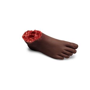 Small Adult Trauma Foot