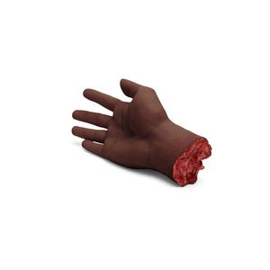 Large Adult Trauma Hand