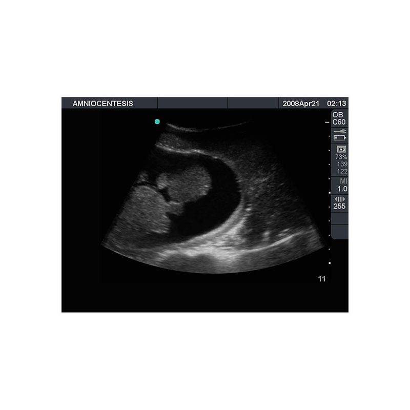 amniotic_fluid_aspiration_ultrasound_phantom_mannequin