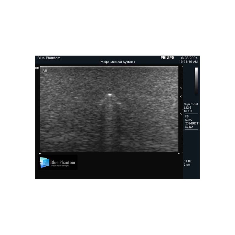 BB_ultrasound_image_phantom