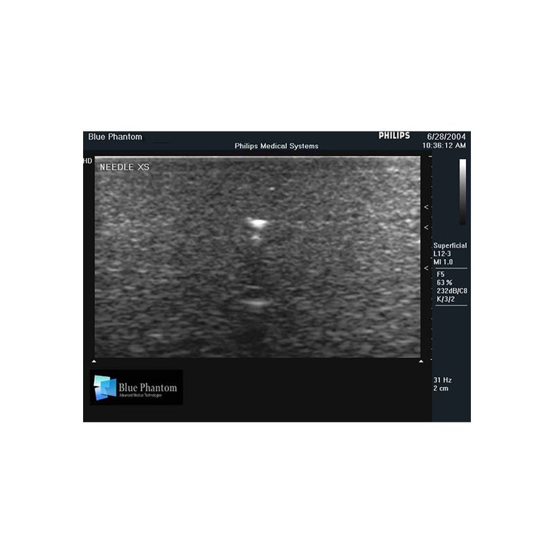 needle_foreign_body_identification_ultrasound