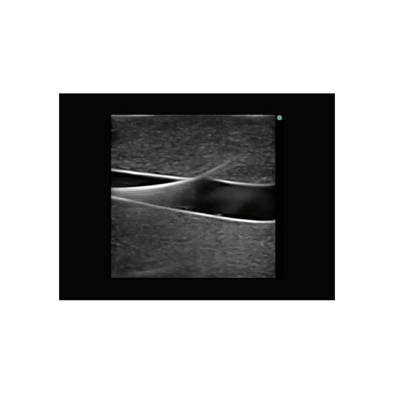 sapheno_femoral_vascular_access_ultrasound_model