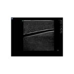 venous_access_ultrasound_image_sagittal_2-vessel