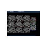 4d_intrauerine_pregnancy_endovaginal_ultrasound_training_mannequin